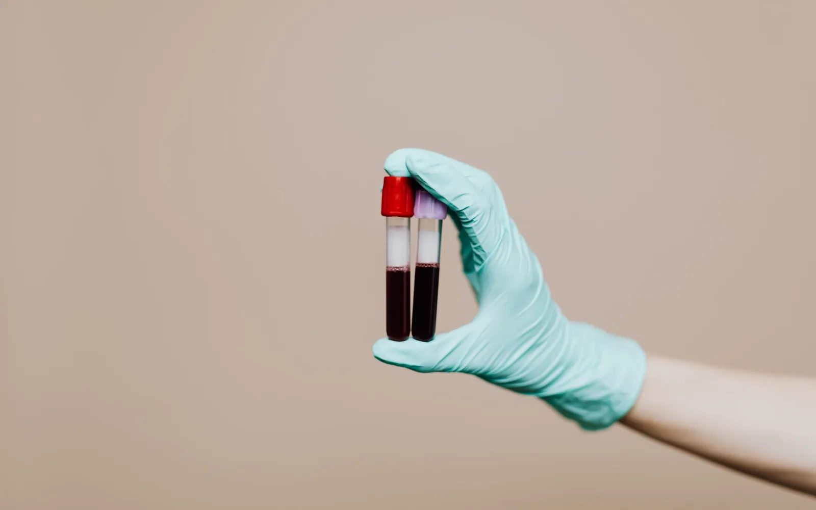 A gloved hand holds two blood sample tubes